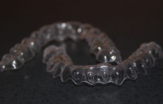 Straightening your Teeth can be Good for Your Health and Enhances Your Smile