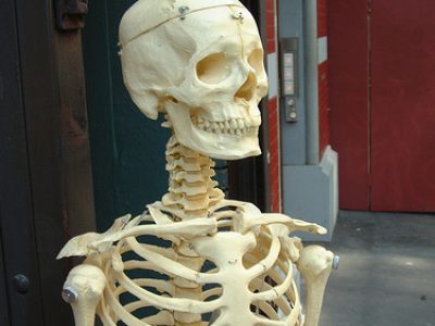 Lose Weight to Fight Osteoporosis