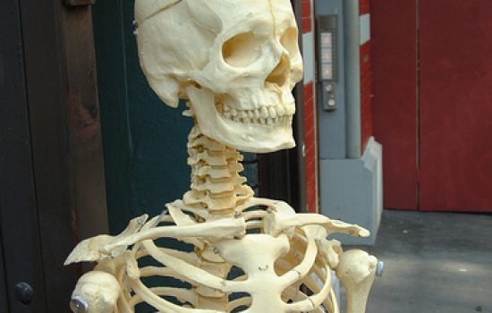 Lose Weight to Fight Osteoporosis