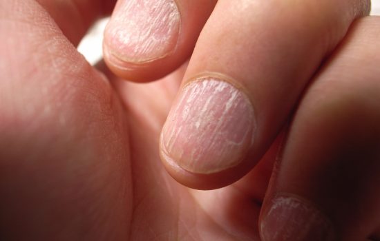 Health and Disease in Nails