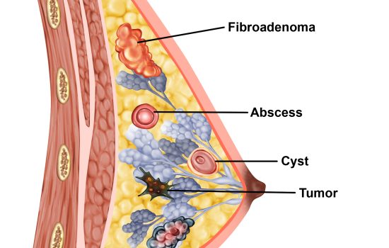The anatomy of the female breast